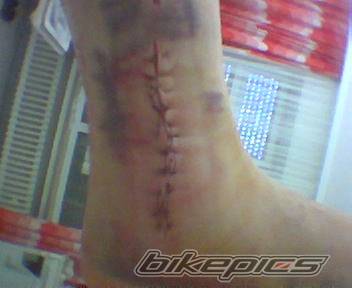 2001 KTM 620 SC | Picture 235796 motorcycle photo